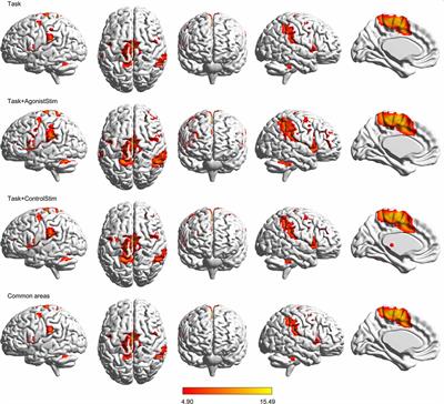 Weak but Critical Links between Primary Somatosensory Centers and Motor Cortex during Movement